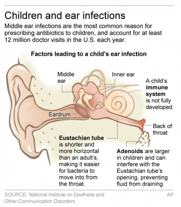 Graphic shows middle ear area and why children are prone to ear infections