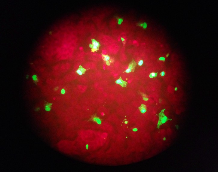 FILE - In this Feb. 26, 2015 photo taken through the eyepiece of a microscope, human cells infected with the flu virus glow green under light from a fluorescence microscope at a laboratory in Seattle. The U.S. government estimates that 80,000 Americans died of flu and flu complications in the winter of 2017-2018 - the highest flu-related death toll in at least four decades. (AP Photo/Ted S. Warren)